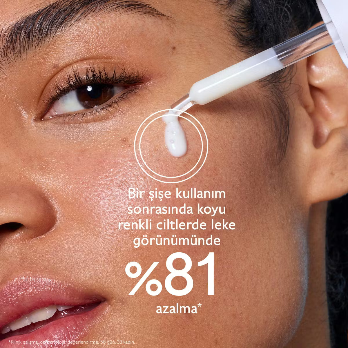 Vinoperfect Leke Karşıtı Işıltı Verici Serum - 30ml