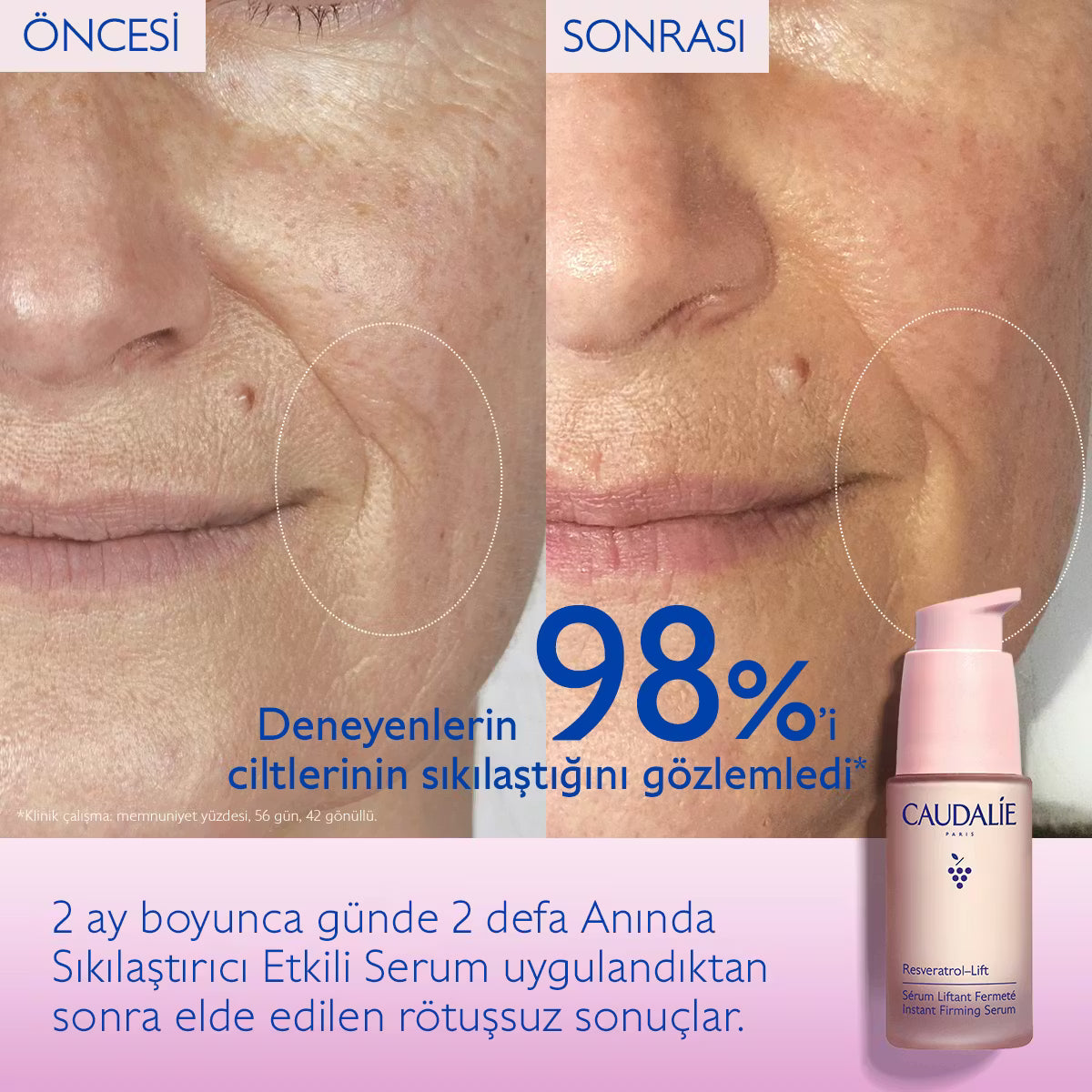 Resveratrol-Lift Anında Sıkılaştırıcı Etkili Serum