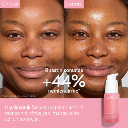 VinoHydra Hiyalüronik Serum
