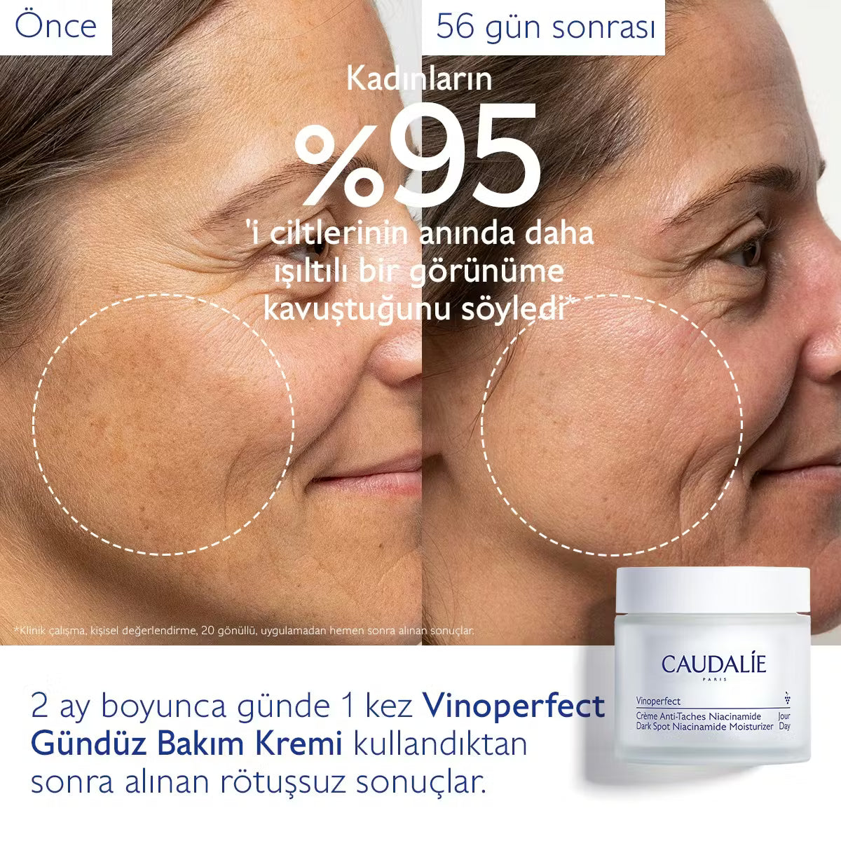 Vinoperfect Leke Karşıtı Niasinamid Gündüz Bakım Kremi