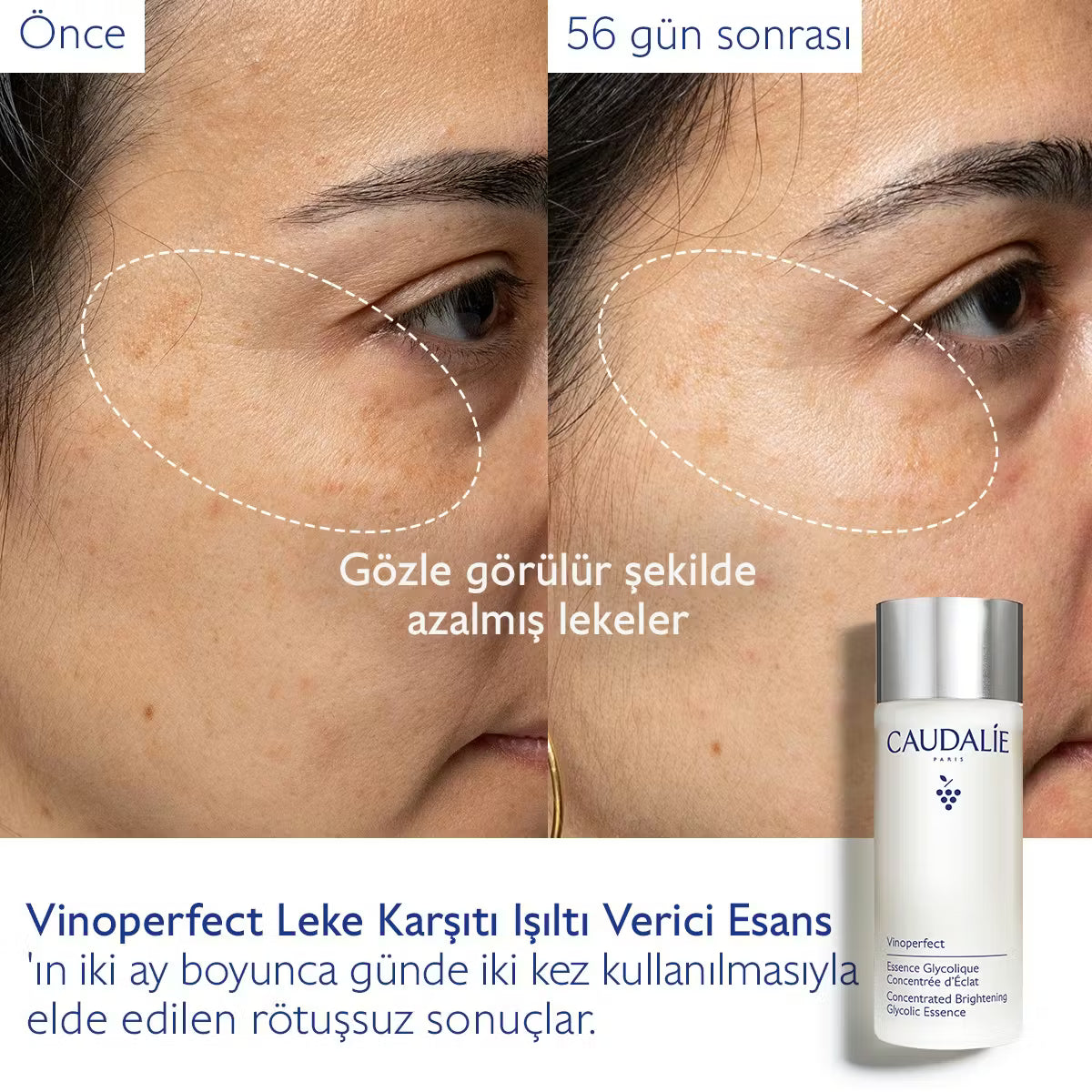 Vinoperfect Leke Karşıtı Işıltı Verici Esans