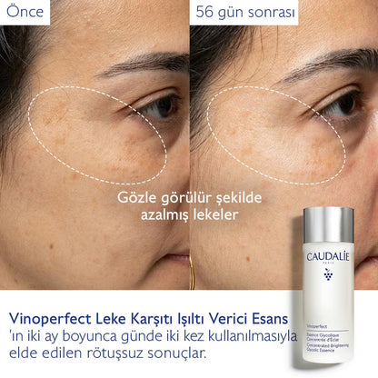 Vinoperfect Leke Karşıtı Işıltı Verici Esans