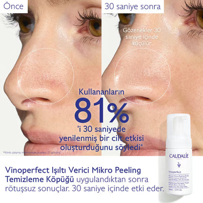 Vinoperfect Işıltı Verici Mikro Peeling Temizleme Köpüğü - 50mL