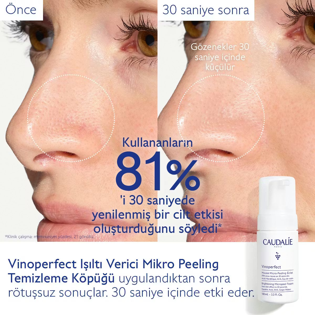 Vinoperfect Işıltı Verici Mikro Peeling Temizleme Köpüğü