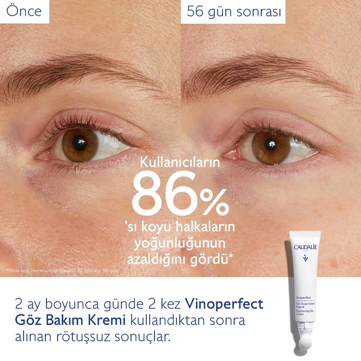 Vinoperfect Işıltı Verici Göz Bakım Kremi