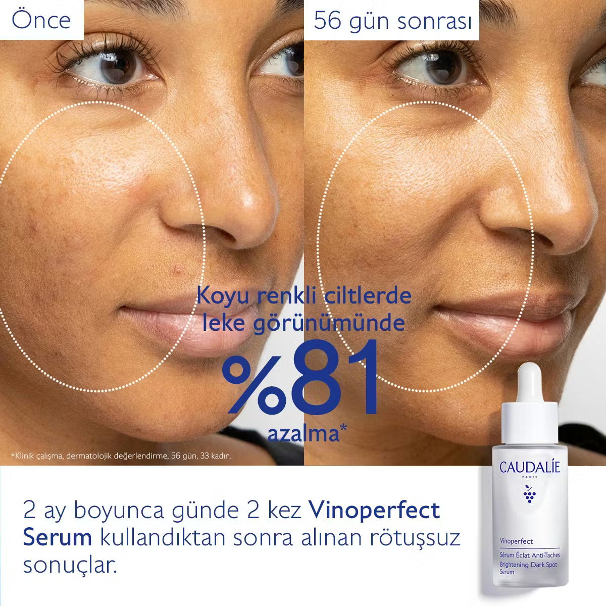Vinoperfect Leke Karşıtı Işıltı Verici Serum - 30ml