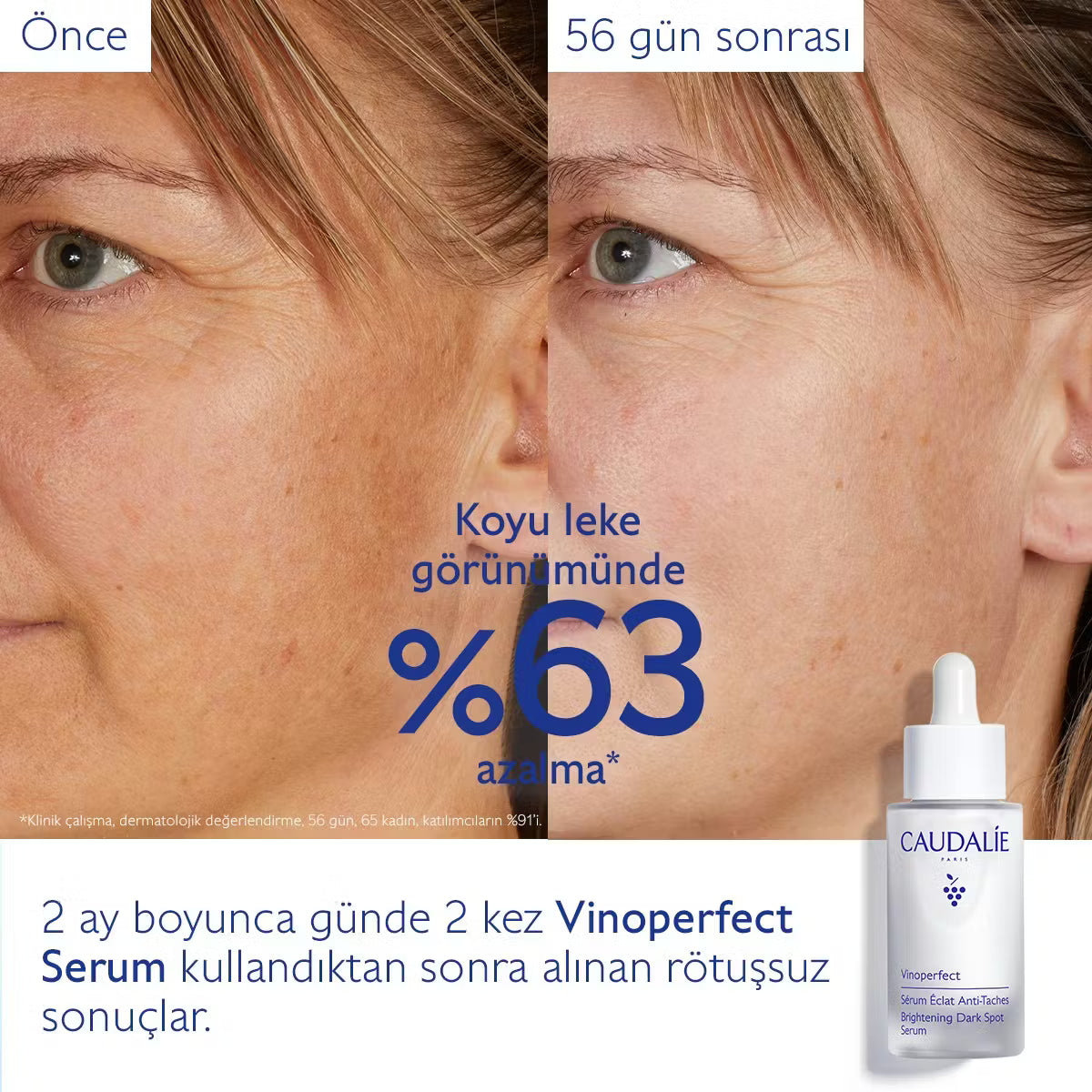 Vinoperfect Leke Karşıtı Işıltı Verici Serum - 30ml